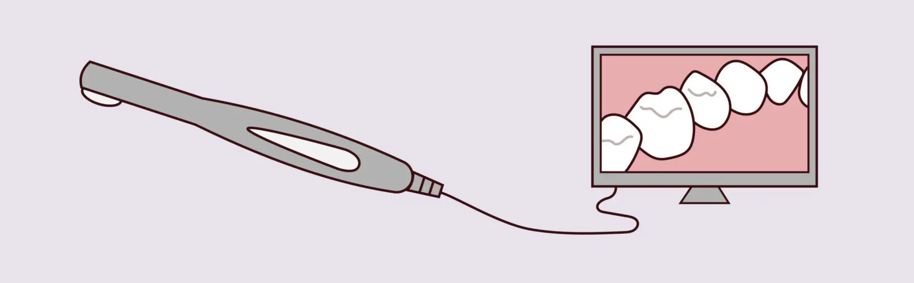 Intraoral Camera Technology -