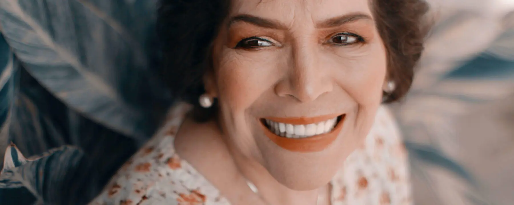 Implant-Retained Partials -