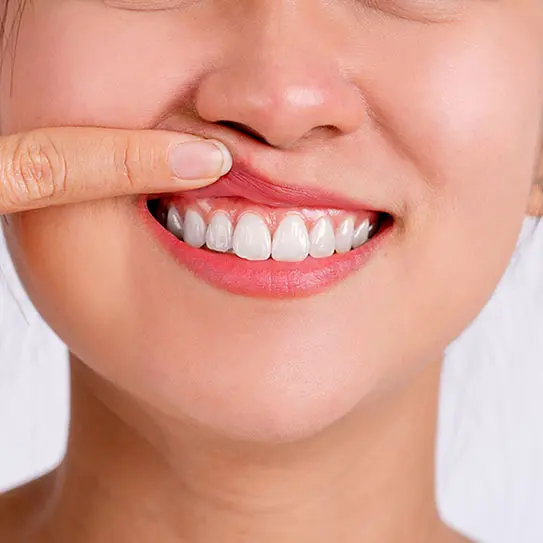 How Can I Defend Against Gum Recession? -