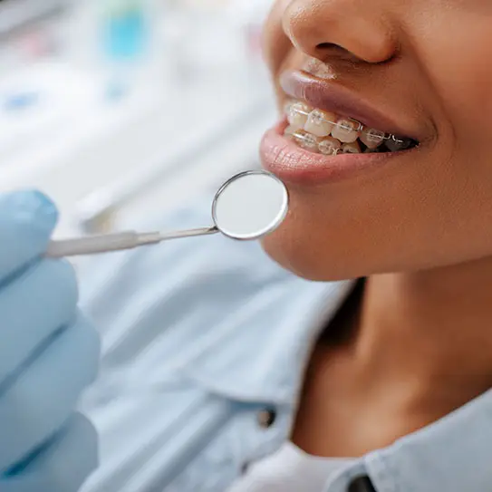 Six Month Smiles Laytonsville Olney