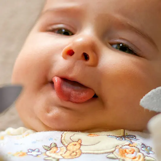 Lip and Tongue Ties: A Guide for Parents -