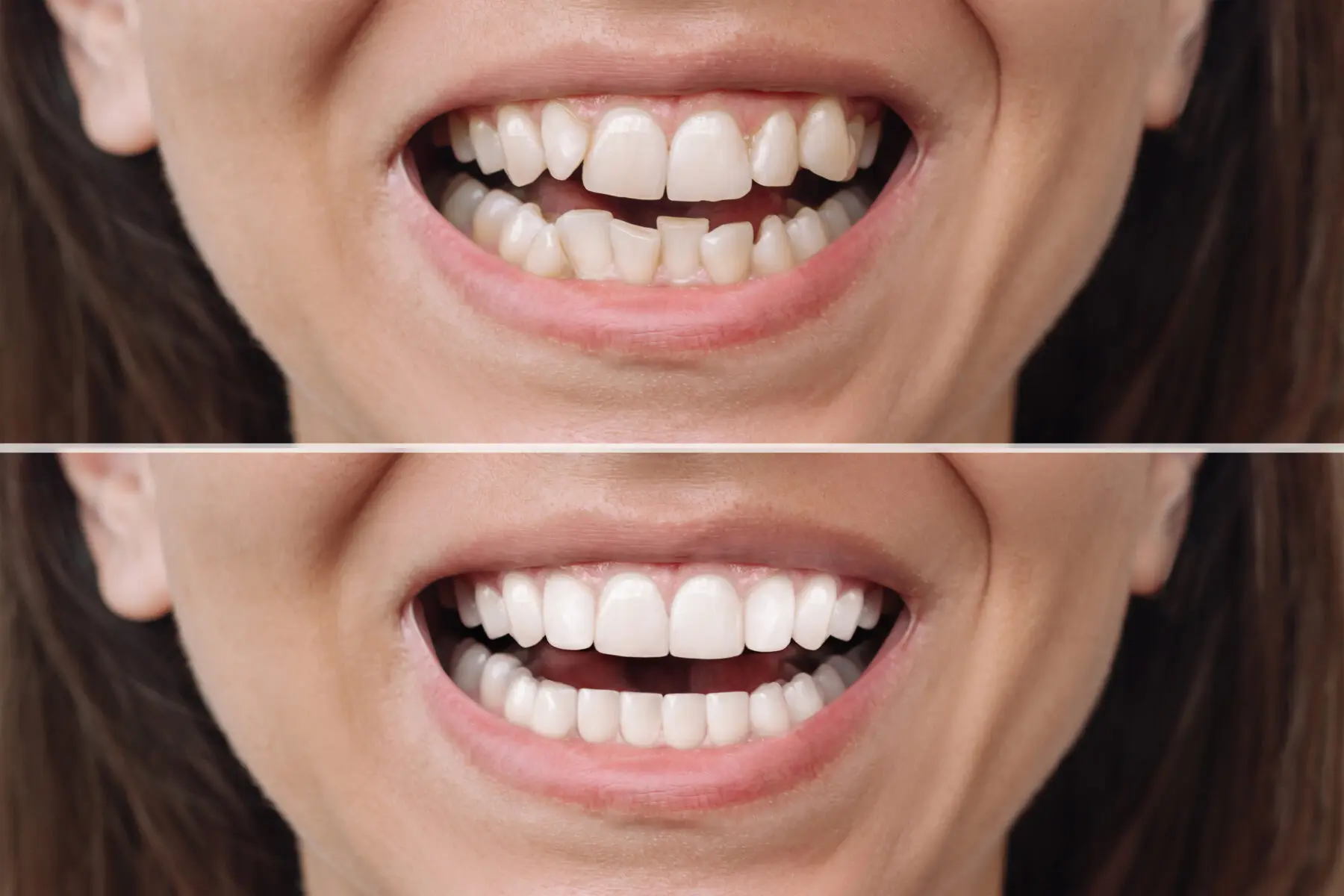 cosmetic dentist in Germantown
