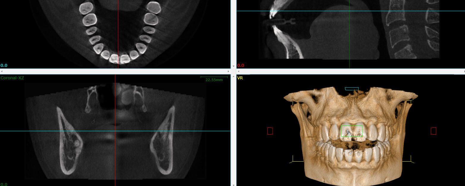 Cone Beam 3D Imaging -