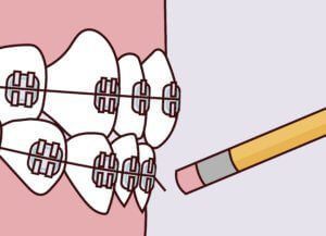 Orthodontic Emergencies -