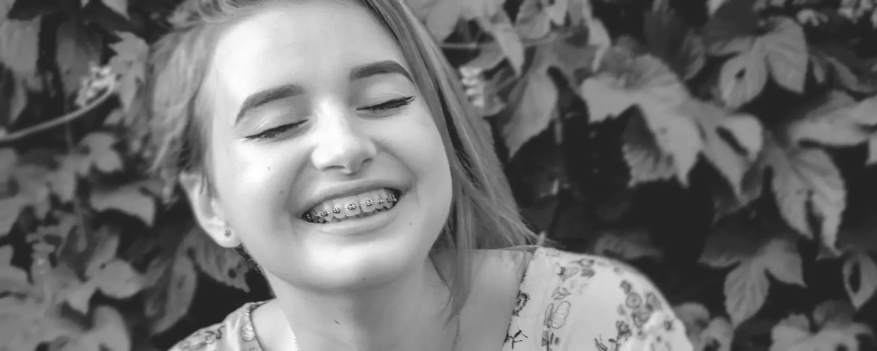 Orthodontic Treatment -